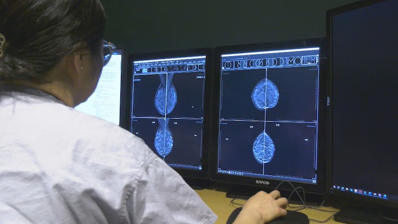 N.B. Green Party says wait times for breast cancer screenings are too long