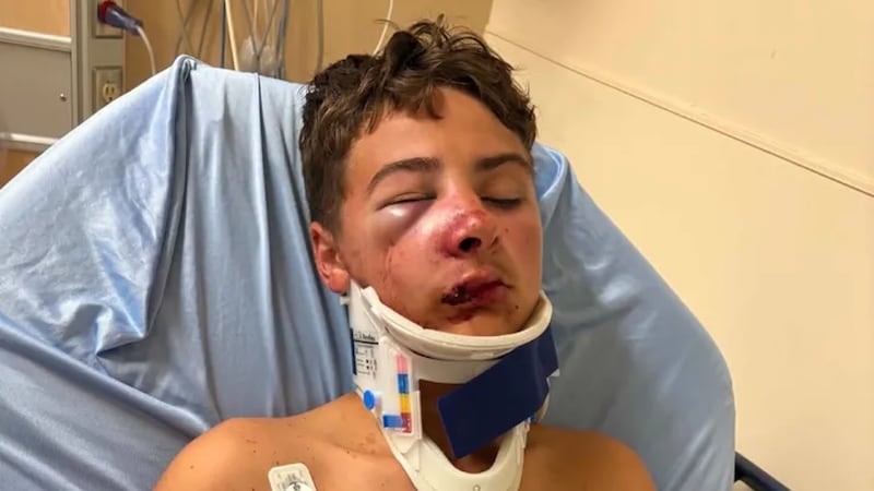 Youth seriously hurt in Greater Sudbury skate park attack
