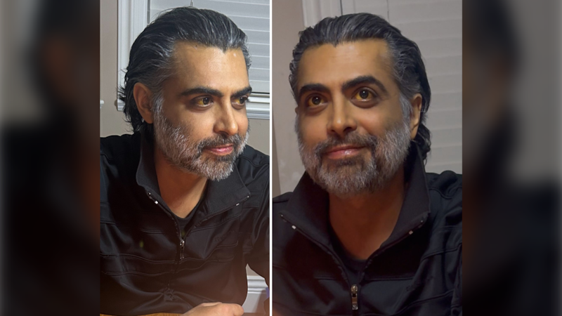 Police, family concerned for well-being of missing man with liver disease