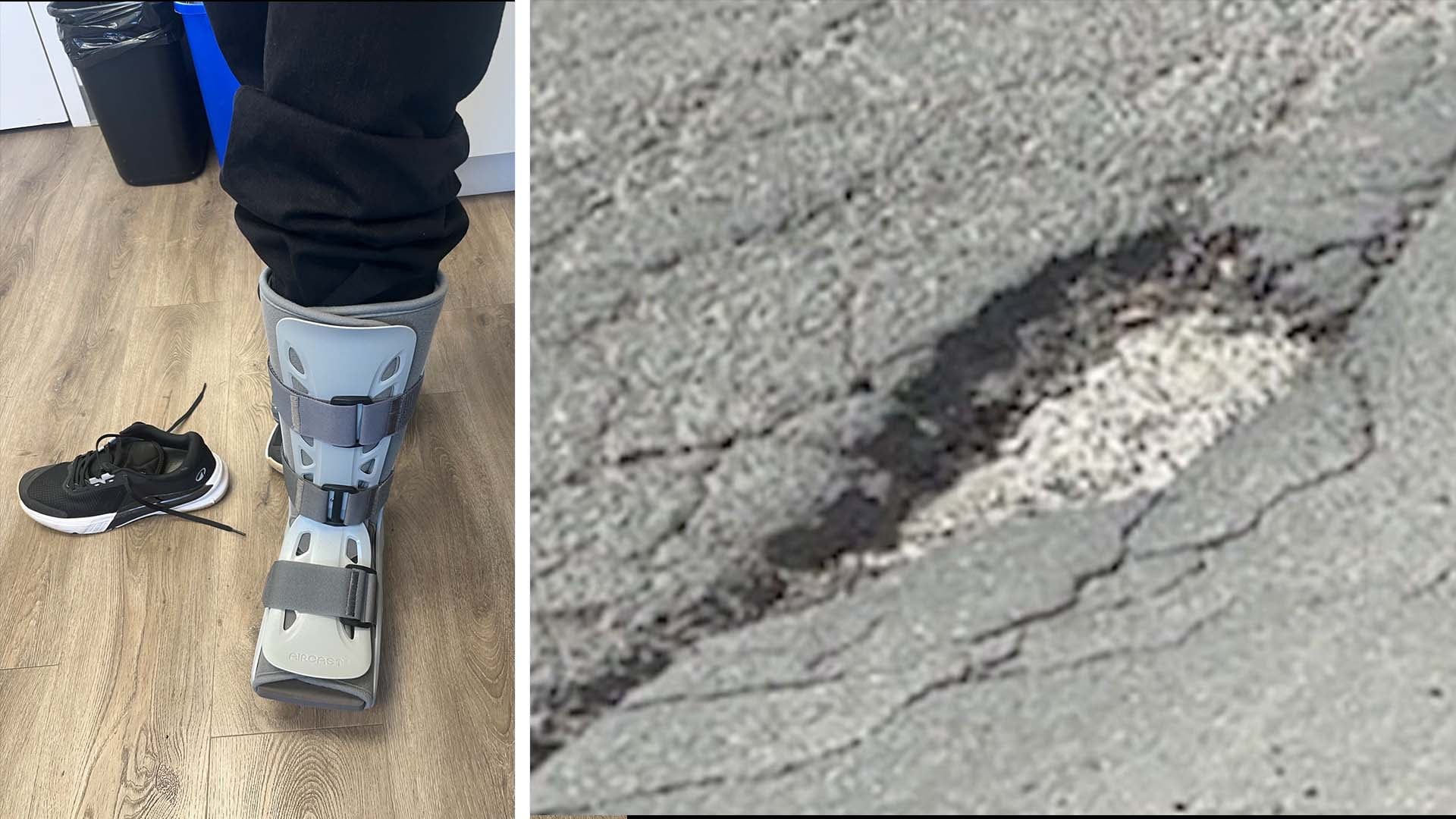 ‘I just went...flying’: Montreal woman fractures ankle in pothole on way ho