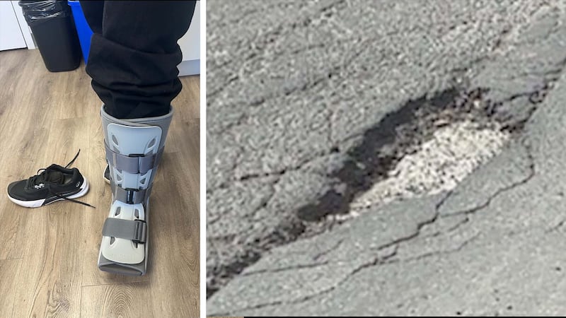 ‘I just went...flying’: Montreal woman fractures ankle in pothole on way home from concert