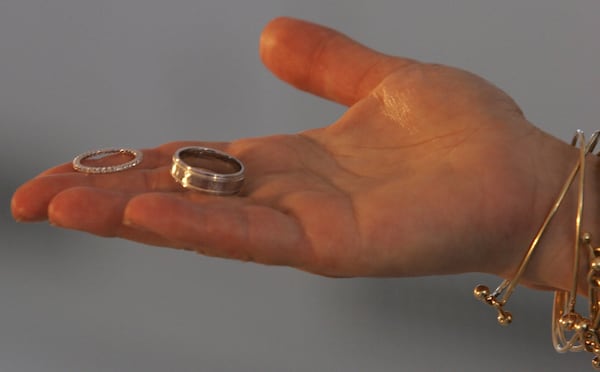 Being married may come with an unexpected health benefit, study suggests