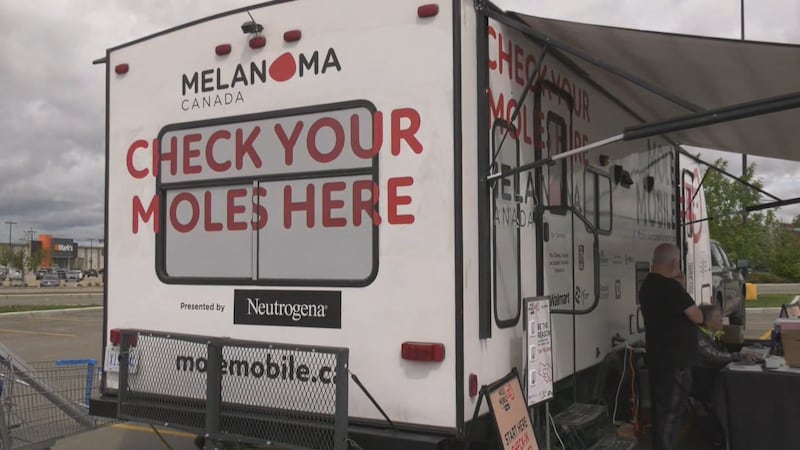 Mole Mobile brings free skin cancer screenings to Nova Scotia, New Brunswick