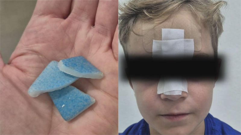 ‘Blood was pouring down his face’: Mom shocked after boy badly cut in resort swimming pool in the DR