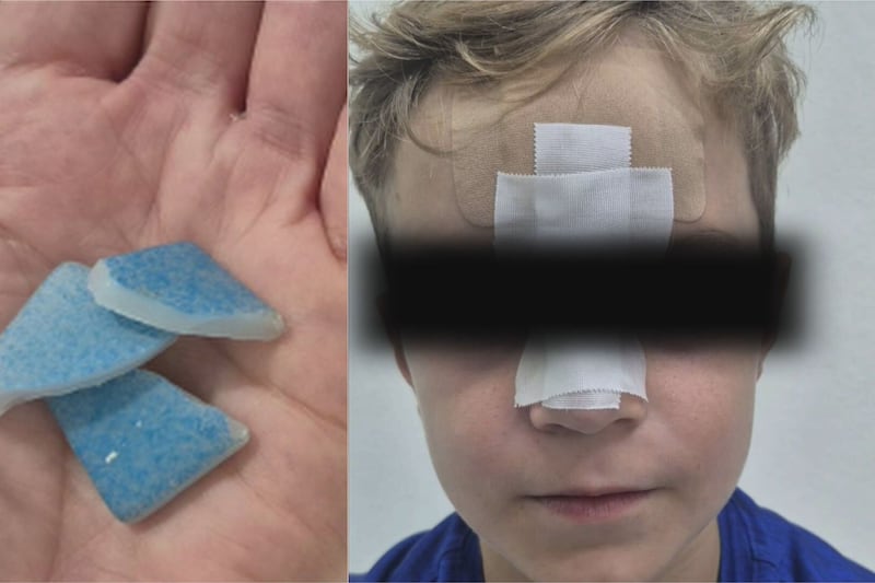 ‘Blood was pouring down his face’: Mom shocked after boy badly cut in resort swimming pool in the DR