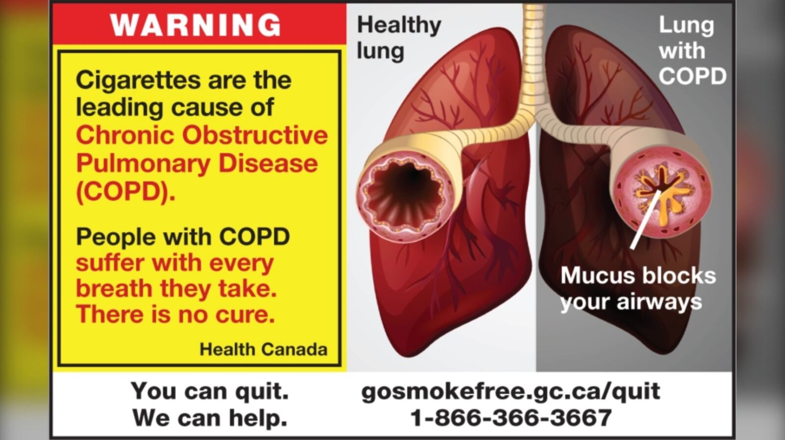 Graphical Health Warning These new graphic health warnings on cigarette packs are meant to ...