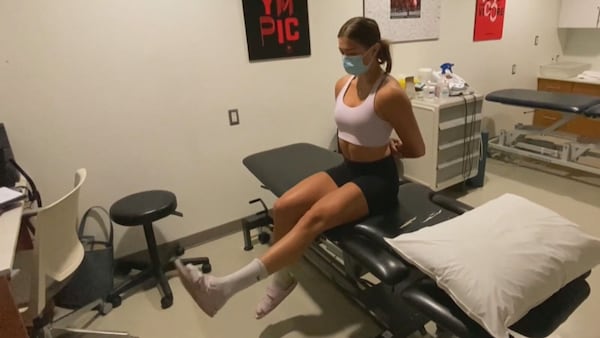 UCalgary research warns of the fallout of rising injuries in female athletes