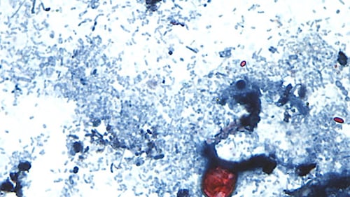 Diarrhea-causing parasite infecting more than 1,200 in Michigan has not spread to Canada: PHAC
