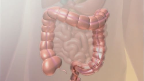 ‘Absolutely essential’: Ontario lowers colorectal cancer screening age to 45