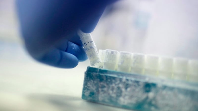 Sperm cells are at their highest quality in summer, study finds