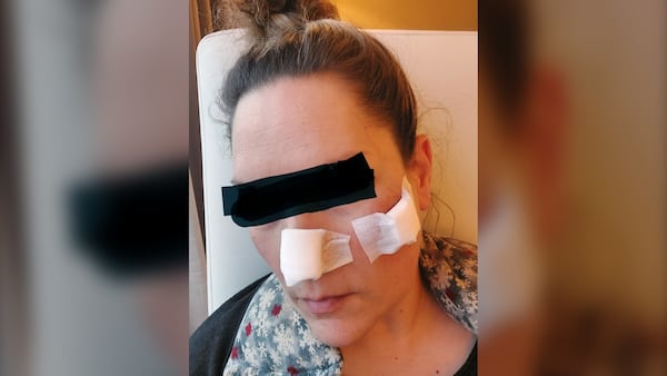 Denied by Ontario: Woman pays $30K for U.S. answers to tissue-destroying disease