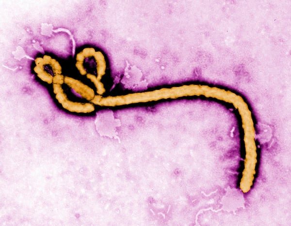 U.S. announces some airport screening for Ebola, one American infected