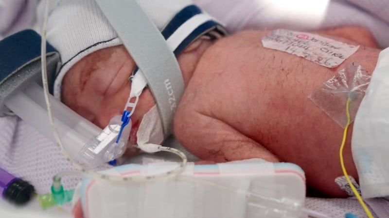 An Australian woman gives birth to rare identical quadruplet girls