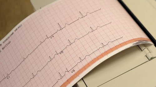 Atrial fibrillation procedure a Canadian first for Montreal’s Heart Institute