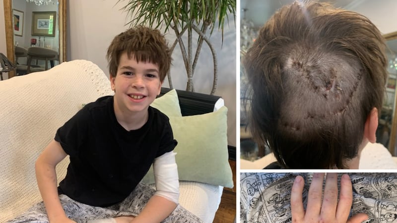 ‘I was going to die’: 11-year-old dog attack victim speaks out