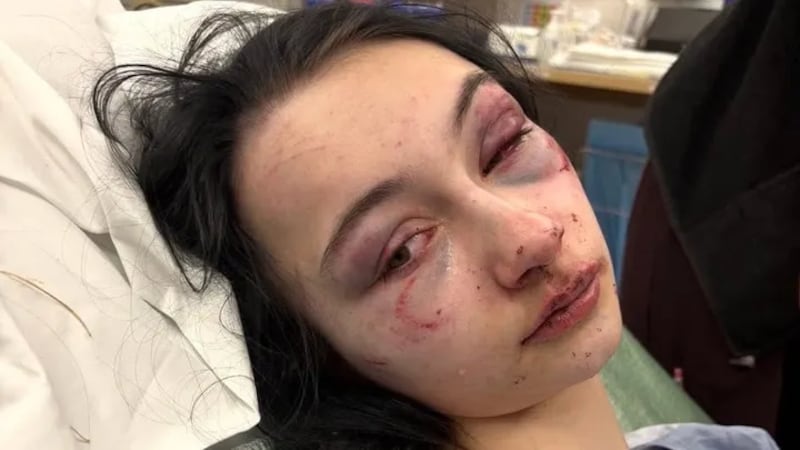 ‘Horrifying’: 2 teens charged in assault that left girl seriously injured in Red Deer