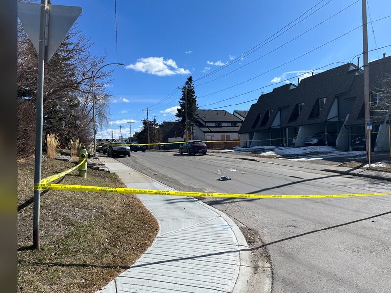 Man in life-threatening condition following assault in northwest Calgary