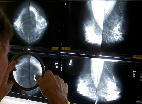 Province improving access to breast cancer screening in southern Manitoba