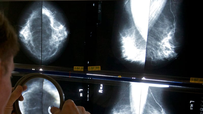 Quebec faces one of the highest rates of breast cancer in Canada