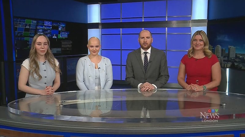 May 5, 2026: Alopecia awareness