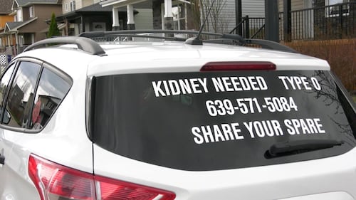 CTV National News: Saskatchewan woman in need of kidney donor turns to unique method