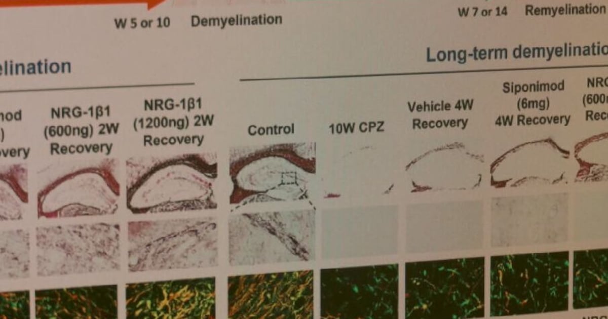 MS treatment breakthrough, Winnipeg apartment explosion: Your Morning Winnipeg - CTV News