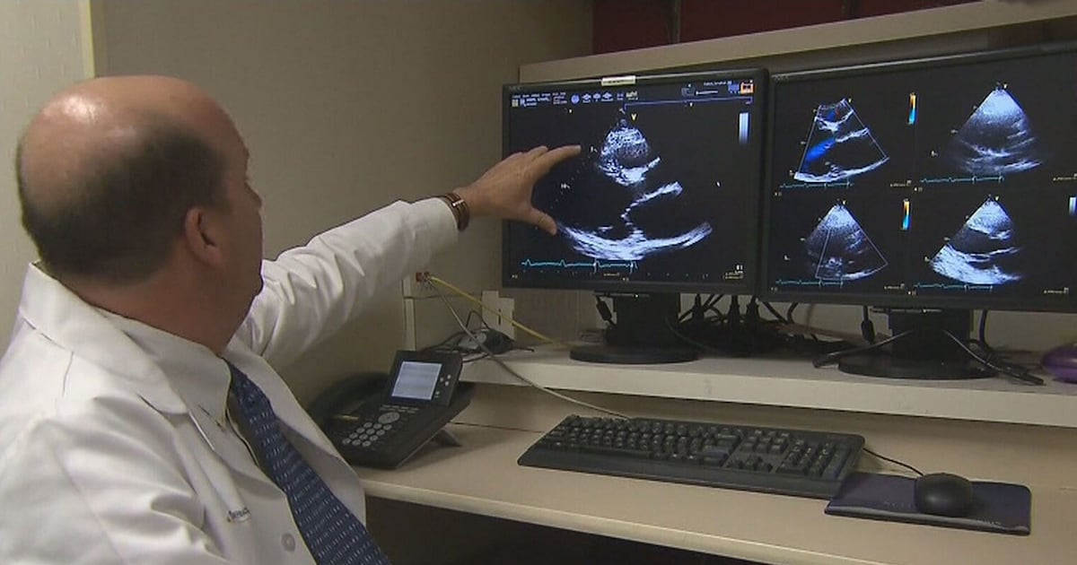 Stroke rates double among young adults: study - CTV News